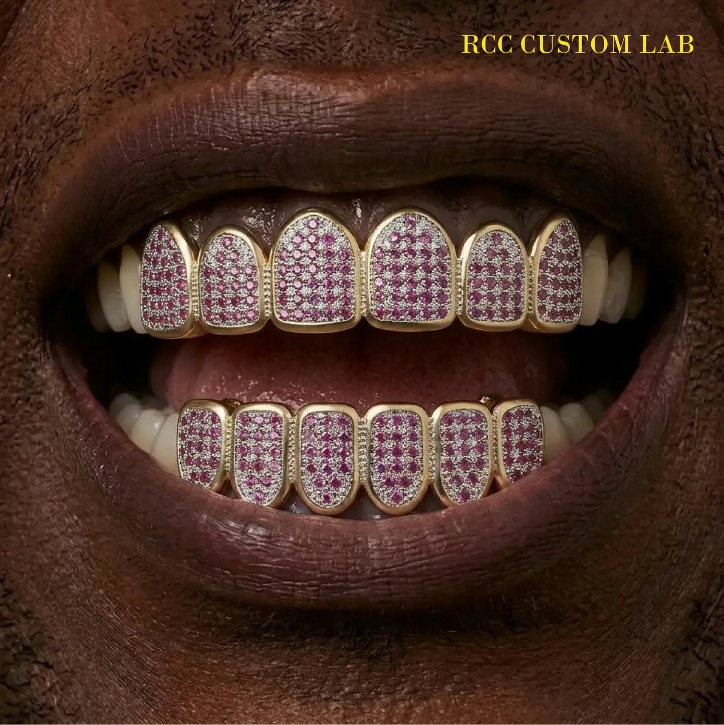 Pink Ruby Pave Gold Grillz【G105】