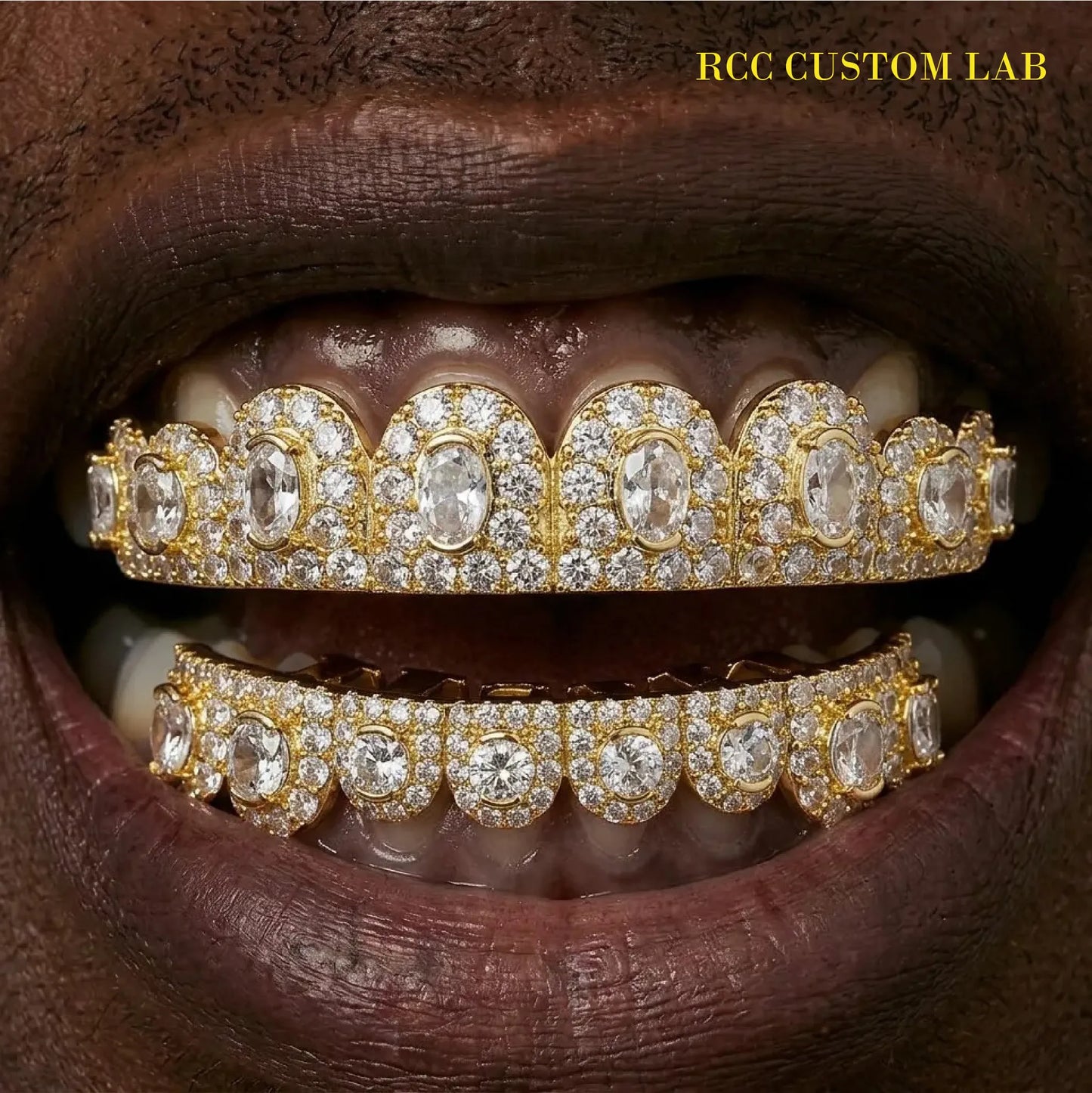 Bezel-Set Diamond Grillz (3-Tone)【G107】